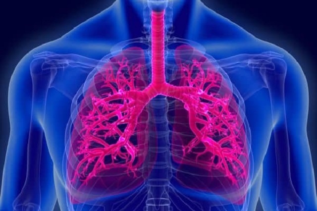 Pendarahan paru-paru, ketahui sebab dan pencegahannya.